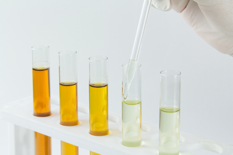 Gloved hand using a pipette over test tubes with colored liquids